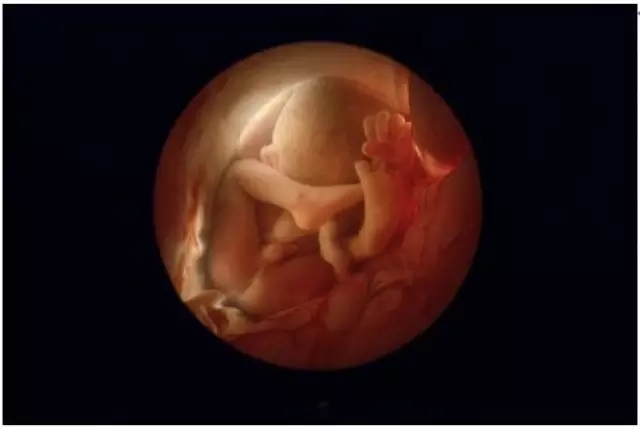 27周的胎儿图片欣赏图片